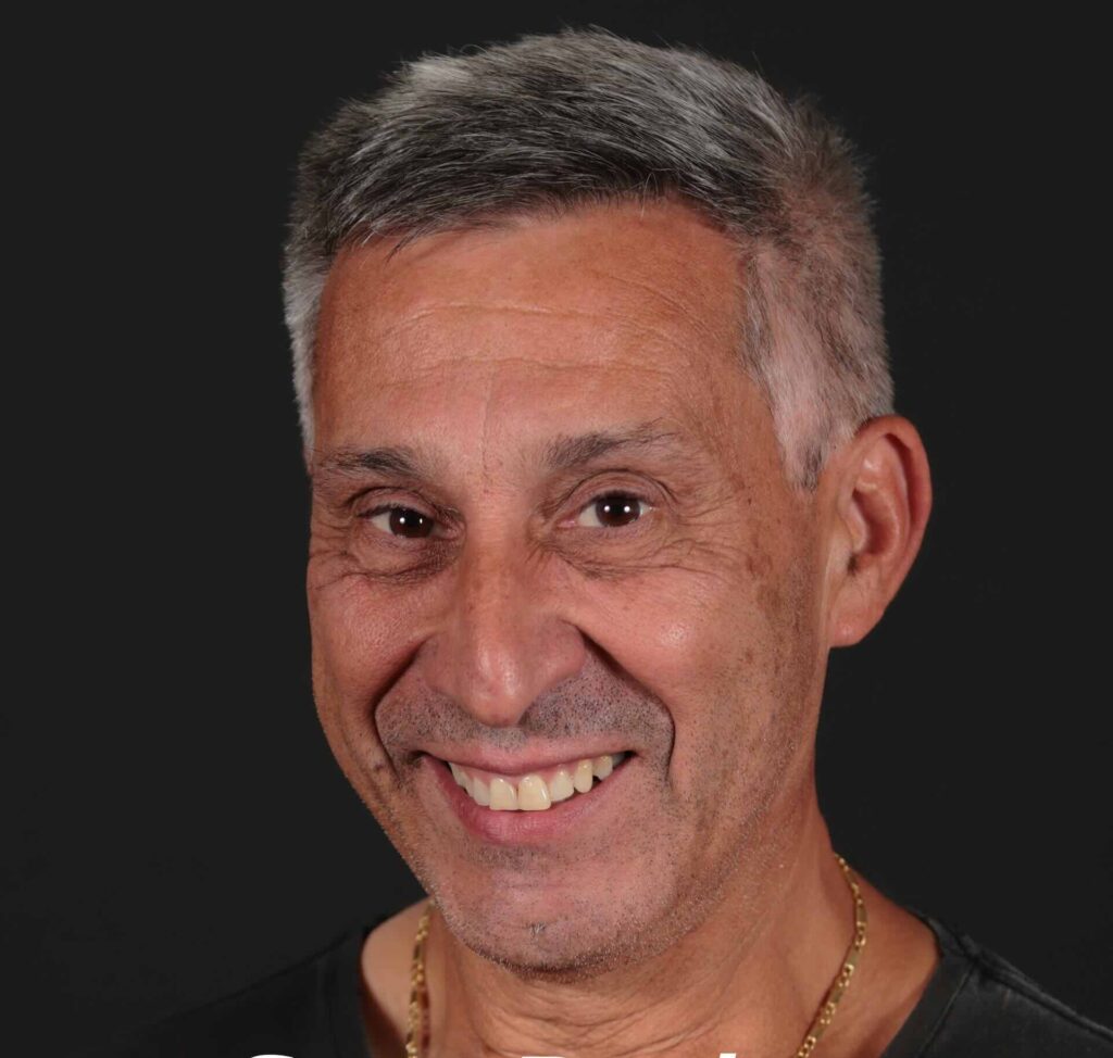 Greg Barison